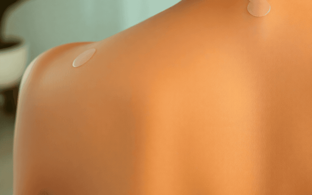 The Science Behind Cupping Therapy: How It Works and What It Does for Your Body