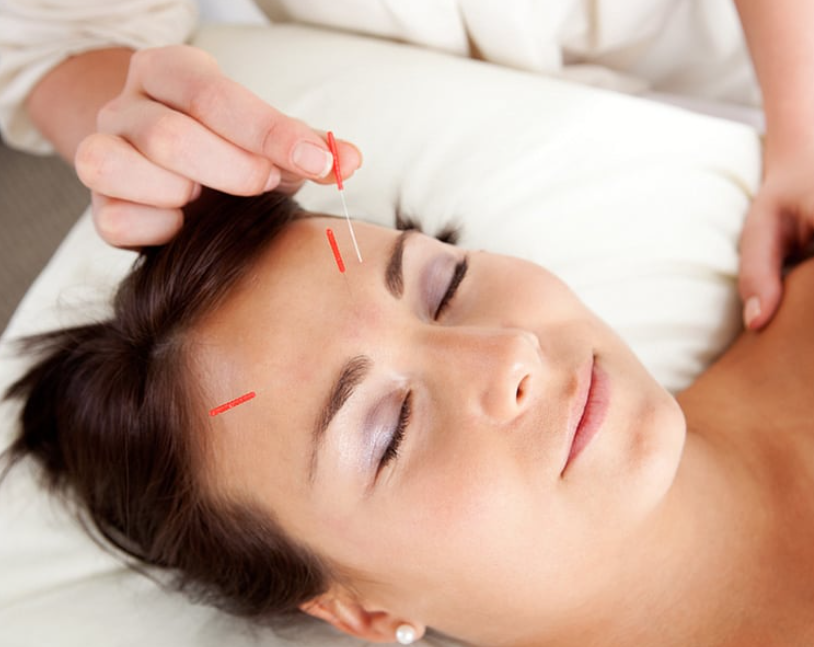 How Acupuncture Can Help Improve Digestion and Relieve Digestive Disorders