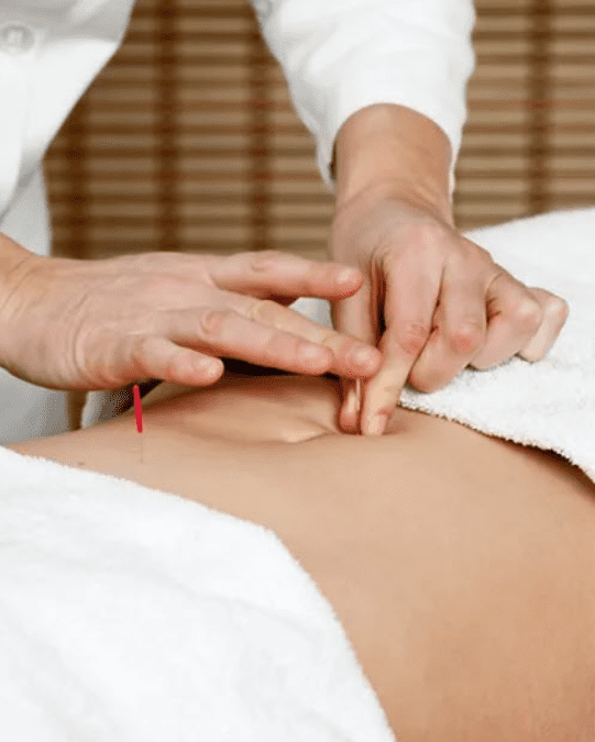 How Acupuncture Works: A Holistic Approach to Healing and Wellness