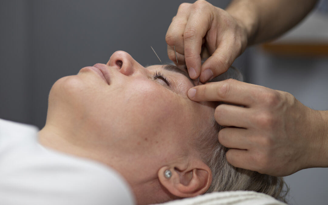 How to Find the Right Acupuncturist in Brookfield for Holistic Healing